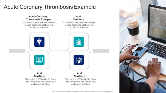 Acute Coronary Thrombosis Example In Powerpoint And Google Slides Cpb