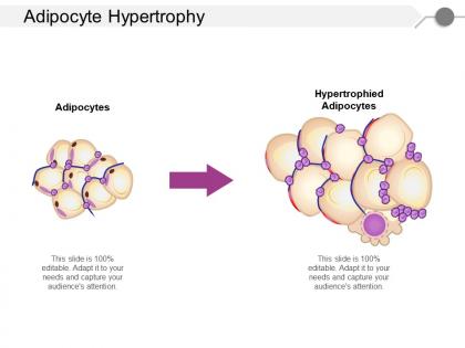 Adipocyte hypertrophy