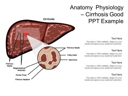 Anatomy physiology cirrhosis good ppt example