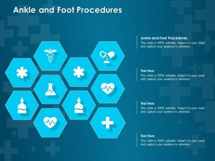 Ankle and foot procedures ppt powerpoint presentation summary show
