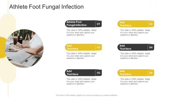 Athlete Foot Fungal Infection In Powerpoint And Google Slides Cpb