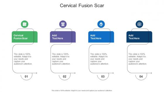 Cervical Fusion Scar In Powerpoint And Google Slides Cpb