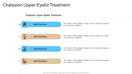 Chalazion Upper Eyelid Treatment In Powerpoint And Google Slides Cpb