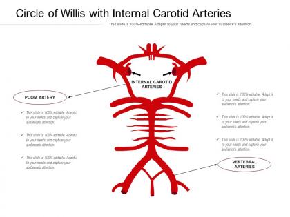 Circle of willis with internal carotid arteries