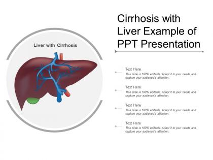 Cirrhosis with liver example of ppt presentation