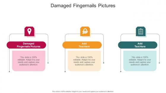 Damaged Fingernails Pictures In Powerpoint And Google Slides Cpb