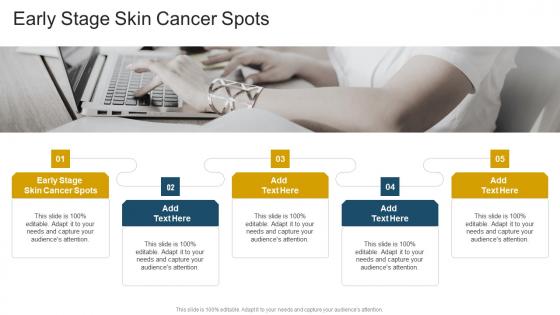 Early Stage Skin Cancer Spots In Powerpoint And Google Slides Cpb