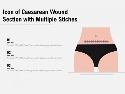 Icon of caesarean wound section with multiple stiches