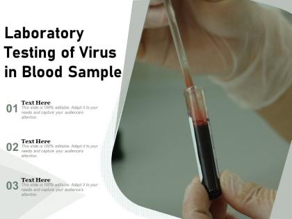 Laboratory testing of virus in blood sample