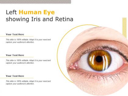 Left human eye showing iris and retina