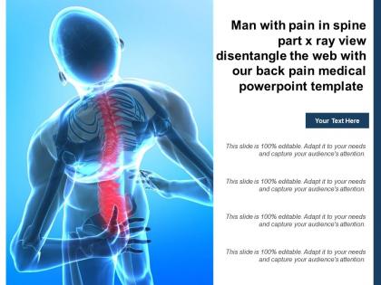 Man with pain in spine part x ray view disentangle web with our back pain medical template