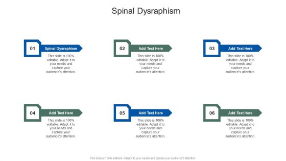 Occult Spinal Dysraphism In Powerpoint And Google Slides Cpb
