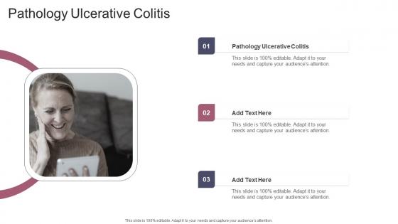 Pathology Ulcerative Colitis In Powerpoint And Google Slides Cpb