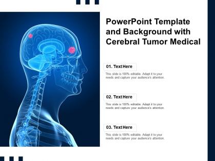 Powerpoint template and background with cerebral tumor medical