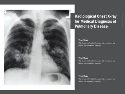 Radiological chest x ray for medical diagnosis of pulmonary disease