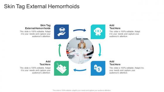 Skin Tag External Hemorrhoids In Powerpoint And Google Slides Cpb