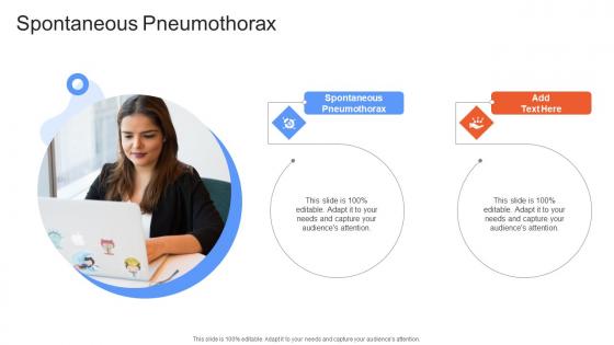 Spontaneous Pneumothorax In Powerpoint And Google Slides Cpb