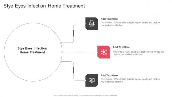 Stye Eyes Infection Home Treatment In Powerpoint And Google Slides Cpb