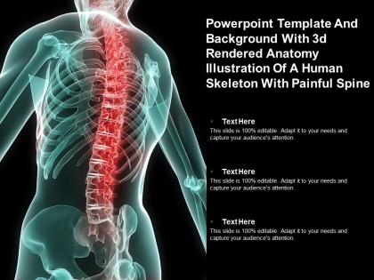 Template with 3d rendered anatomy illustration of a human skeletal back with pain ppt powerpoint