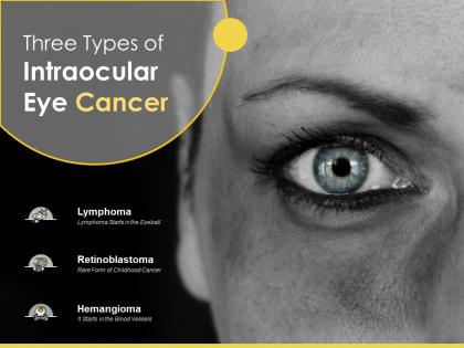 Three types of intraocular eye cancer