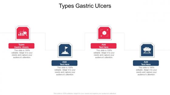 Types Gastric Ulcers In Powerpoint And Google Slides Cpb