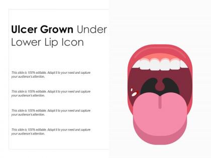 Ulcer grown under lower lip icon