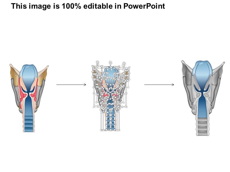 0514 Larynx Medical Images For PowerPoint | PowerPoint ...