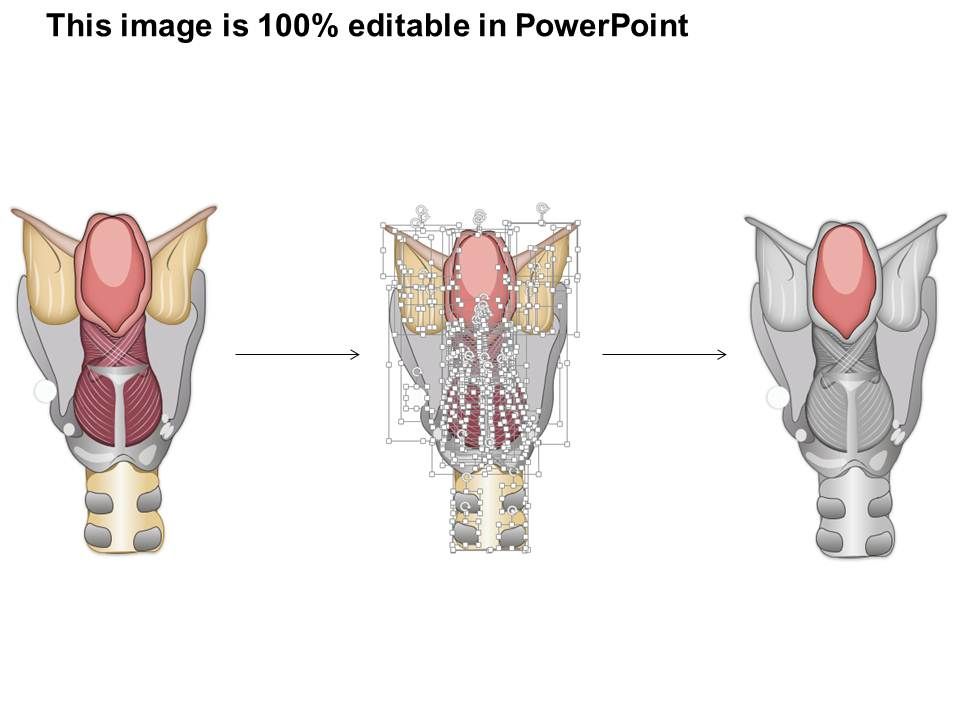 0514 The larynx Medical Images For PowerPoint | PowerPoint ...