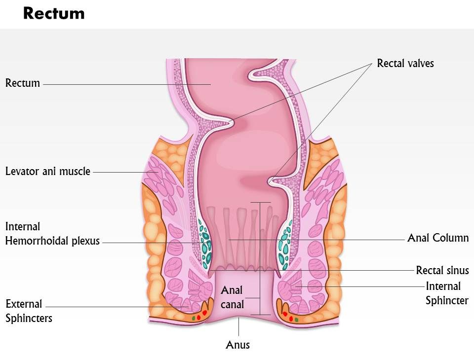 0614 Diagram Of Rectum Medical Images For Powerpoint Powerpoint Slide Templates Download Ppt Background Template Presentation Slides Images