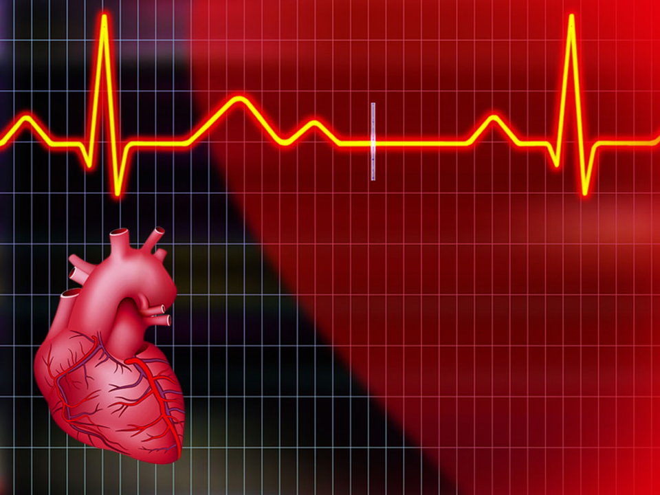 Cardiogram Medical PowerPoint Template