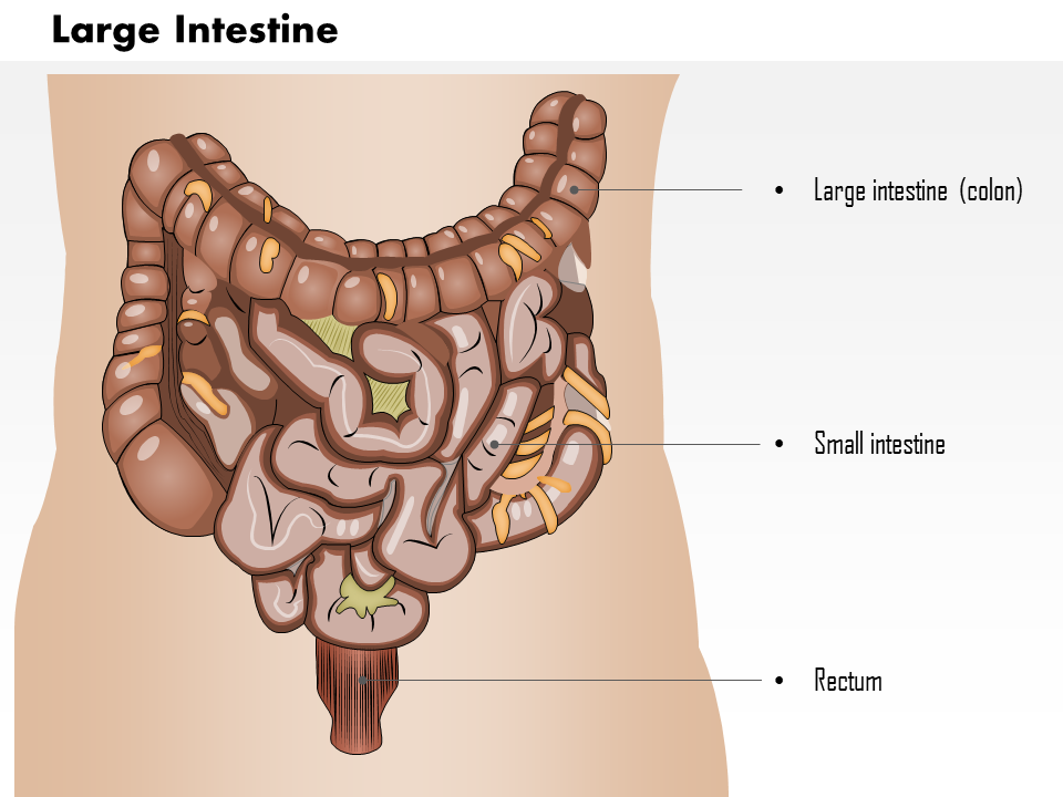 0514 large intestine medical images for powerpoint 0514 large intestine medical images for powerpoint