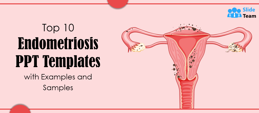 Top 10 Endometriosis PPT Templates with Examples and Samples
