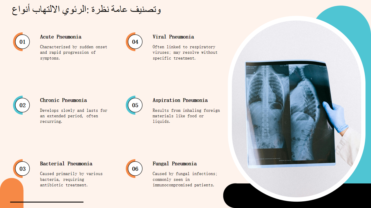 أنواع الالتهاب الرئوي نظرة عامة وتصنيف أنواع الالتهاب الرئوي نظرة عامة وتصنيف